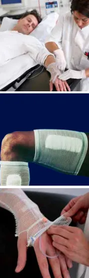 CareFix elastický síťový obvaz Tube (ruka/noha), velikost L