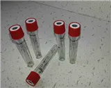 VACUETTE® Zkumavka 3 ml bez přísad, transparentní štítek