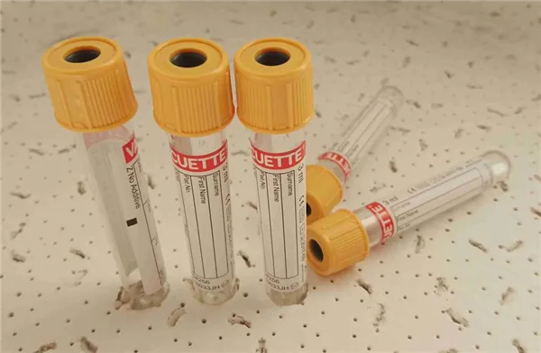 Zkumavka VACUETTE 3ml bez přísad žlutá 