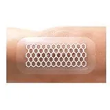 Opsite Post-Op Visible 20 x 10 cm
