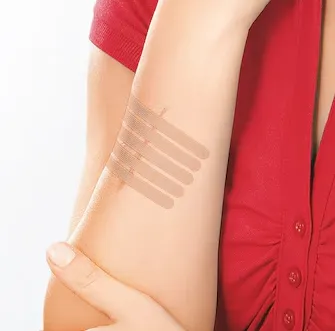 Leukoplast® wound closure strip, 6mm x 38mm (60ks v balení)