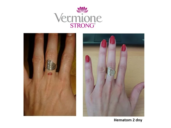 Vermione STRONG korekční a reparační krém
