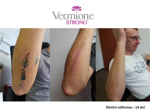 Vermione STRONG korekční a reparační krém