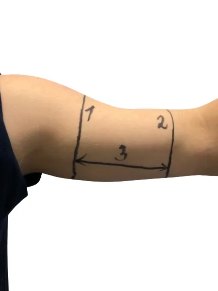 Fixační návlek vel. XL na dia senzor dětský nanoAg modrý
