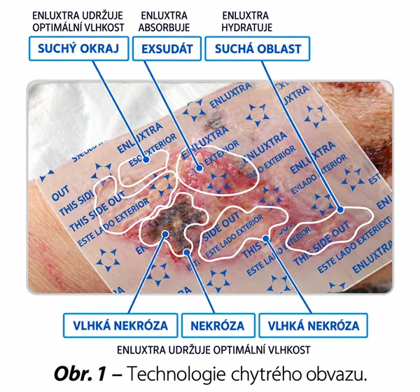 Enluxtra  10 x 10 cm