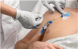 FlexGRIP CVC 4,5-9 Fr bez podkovy, Hydrocolloid(pro centrální katétry)
