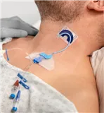 FlexGRIP CVC 4,5-9 Fr s podkovou, Hydrocolloid (pro centrální katétry)