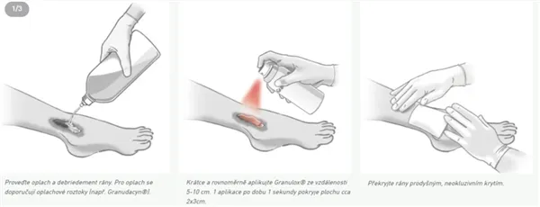 Granulox 12 ml sprej s hemoglobinem